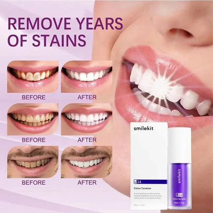 Purple Teeth Whitening Serum V34